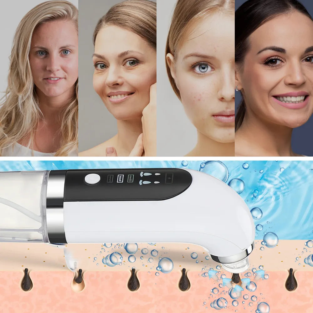 DermiVac Aqua Cleanser