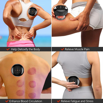 CupRevive Electric Cupping Massager